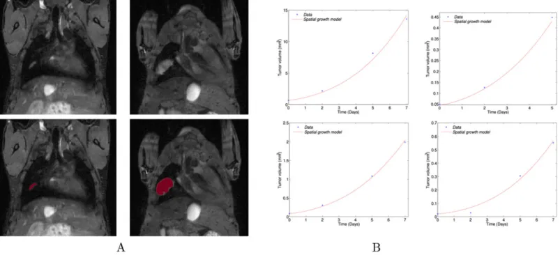 Fig 5. Spatial model fitting. (A) Top: Coronal MRI data of the lungs at days 19 and 26