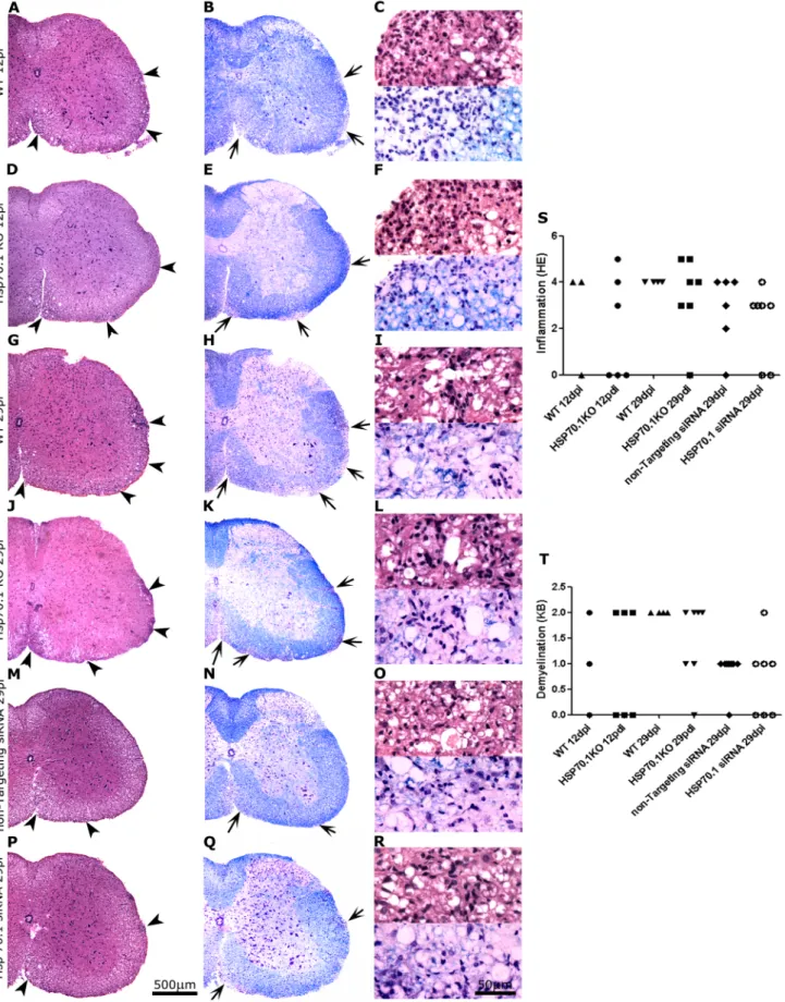 Figure 3. Histopathological study of the spinal cords of Hsp70.1 KO, WT and siRNA-treated mice