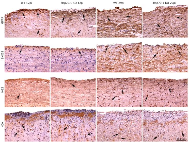 Figure 4. Immunoshitochemical staining for GFAP, SMI32, NG2 and HOx of the spinal cord of Hsp70.1 KO and WT mice.