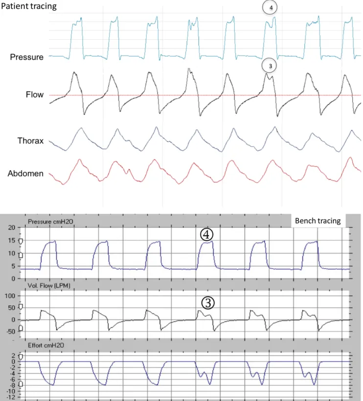Figure S9b: Underassistance in the middle of the cycle 