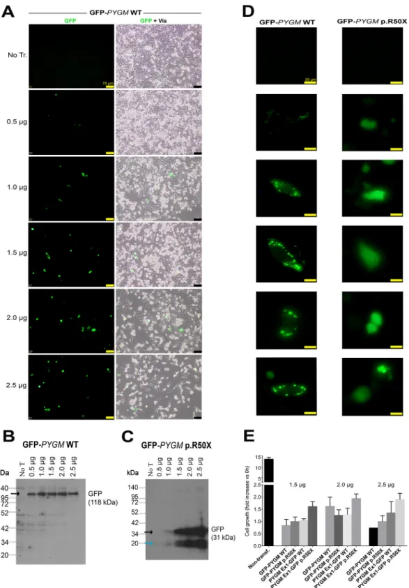 Fig. 2. Transfection efficiency analysis using different amounts of the GFP-PYGM plasmids