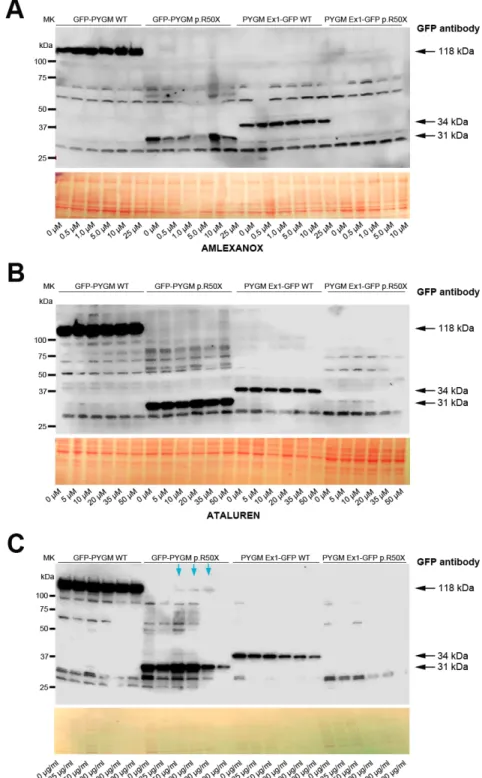 Fig. 4. Read-through analysis in transient transfected cells. (A-C) Read-through analysis in HeLa cells transfected with WT, p.R50X GFP-PYGM and  PYGM-GFP plasmids after 72 h treatment with amlexanox (A), Ataluren (B) and G418 (C)