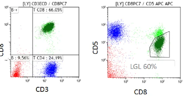 Fig 2: Flow cytometry and TCR  γ  gene rearrangement analysis in LGL leukemia  