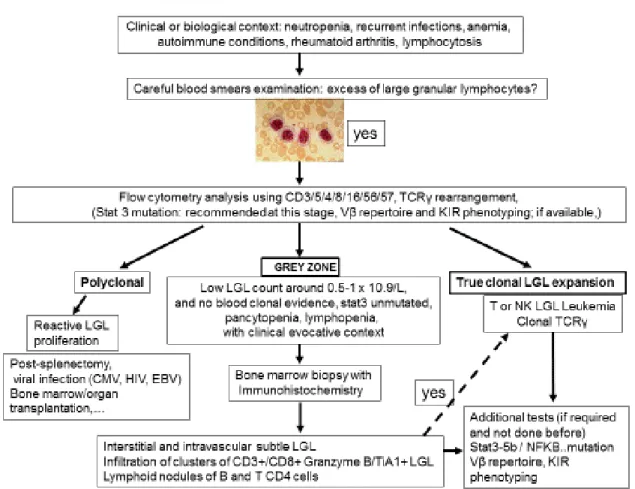 Figure 3: Algorithm of the diagnosis of LGL Leukemia 