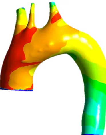 Figure 8: 3D representation of the aortic pressure wall according to simulation 