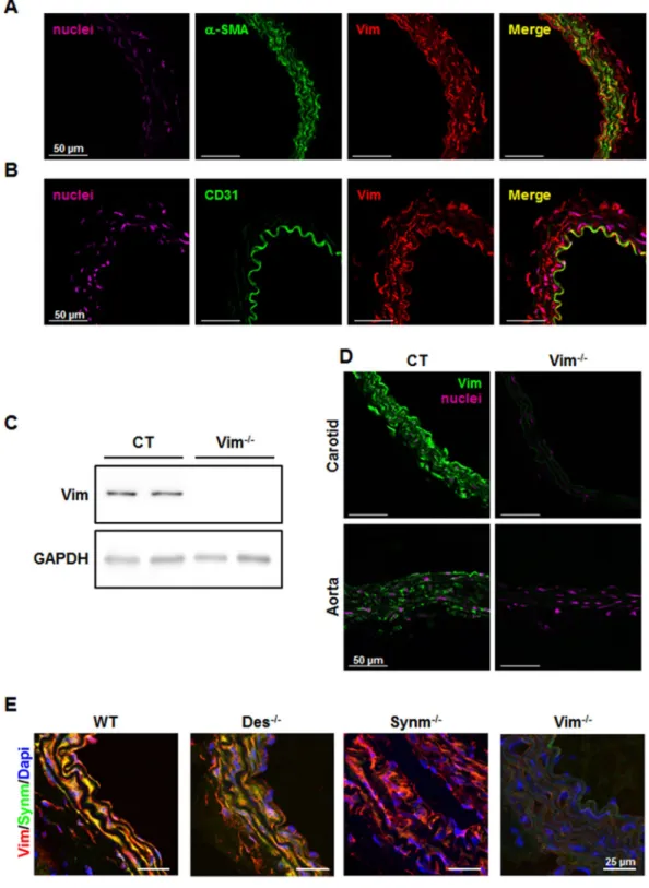Figure 1.  Expression of Vim and its partners in carotid artery and aorta in mice. Confocal immunofluorescence  images of the carotid artery shows the presence of Vim (red) in SM-α-actin-positive (green) SMCs (A) and  CD31-positive (green)ECs (B) in CT mic