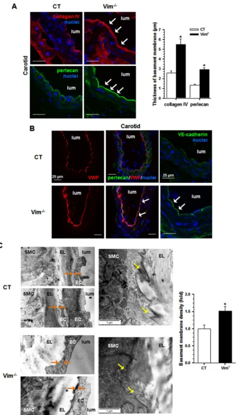 Figure 3.  Effect of Vim knockout on the structure of the carotid artery. (A) Confocal immunofluorescence  images show the increased expression of basement membrane components, collagen IV and perlecan (arrows),  in Vim −/−  mice