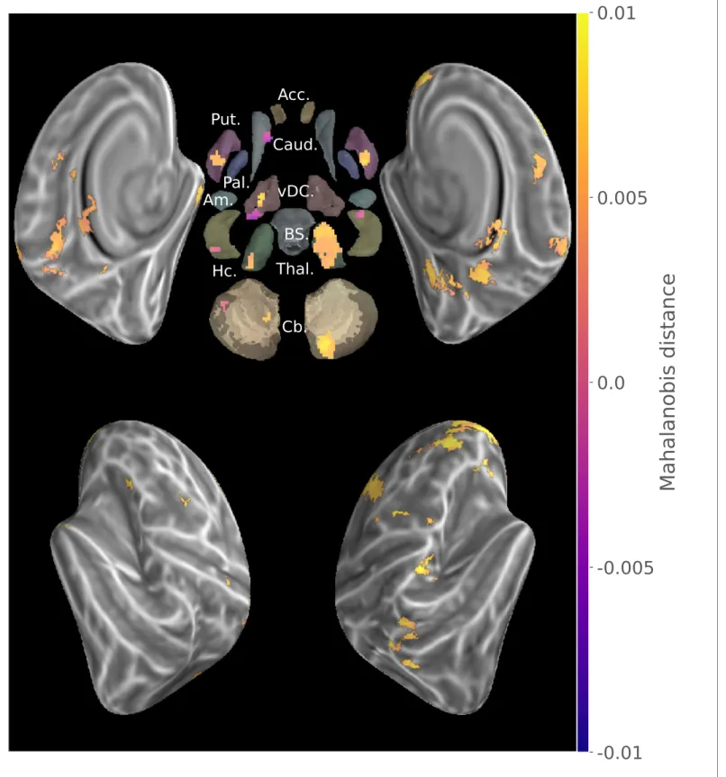 Figure 3. Conjunction of group searchlight contrast (paired t-test) between consolidated and new sequences discriminability maps and separate group discriminability maps for new and consolidated sequences (z-score thresholded at p &lt; .05 TFCE-cluster-cor