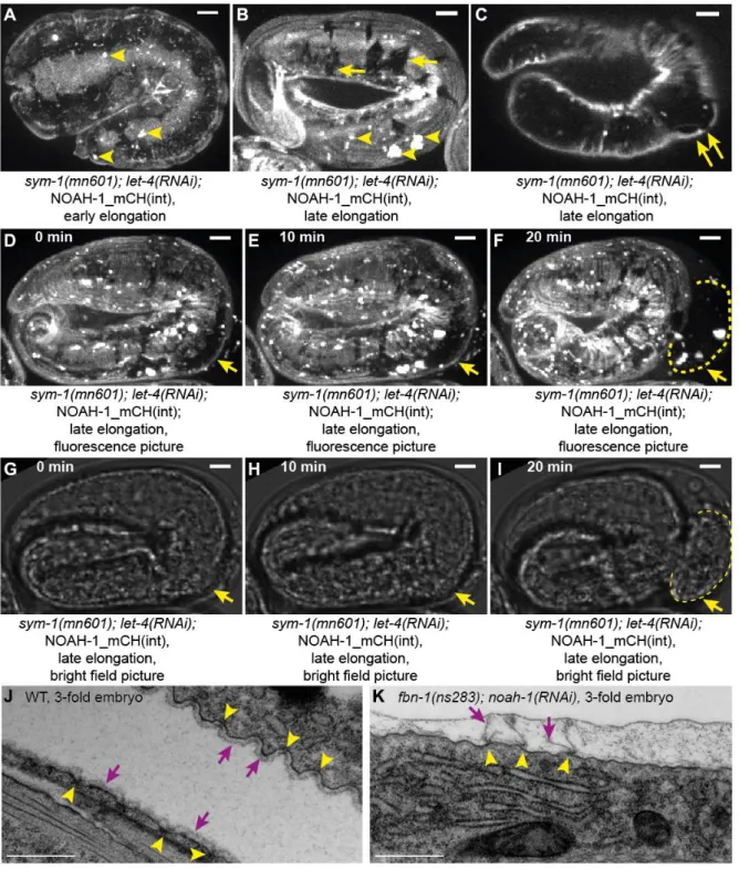 Fig.  5:  Depletion  of  putative  sheath  proteins  damages  the  embryonic  sheath.  (A-I)  NOAH-1_mCH(int);  sym-1(mn601);  let-4(RNAi)  embryos  at  early  (A)  and  late  (BC)  elongation stages, and through a time-lapse sequence (D-I)