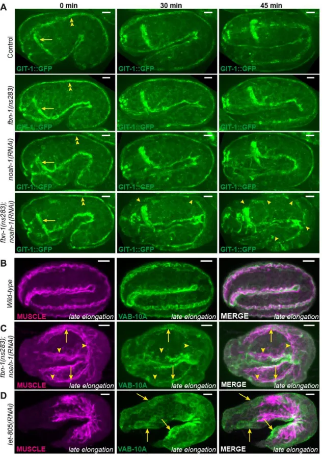 Fig.  6:  Embryonic  sheath  protein  depletion  induces  hemidesmosome  disruption  and  muscle  detachment
