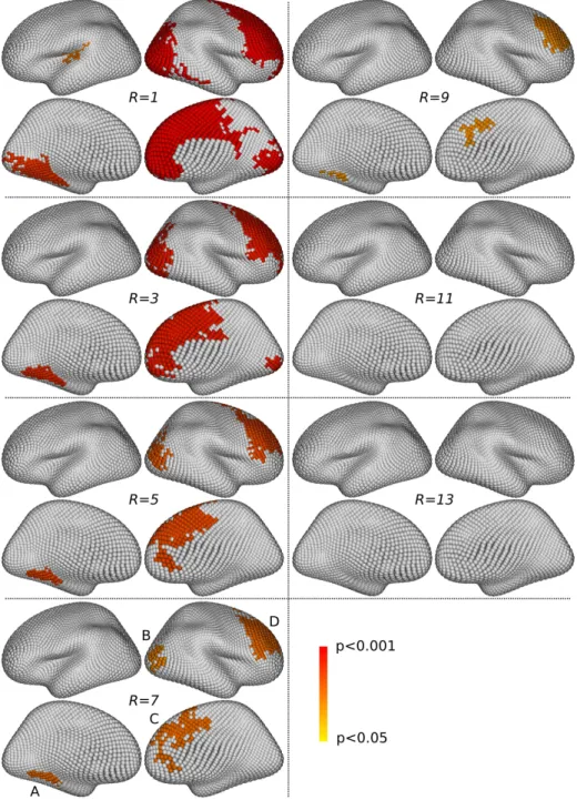Figure 9: Gender differences. Simlarly to Fig.7, four views are presented for each value of R, showing thresholded significant multi-scale clusters (corrected p < 0.05)