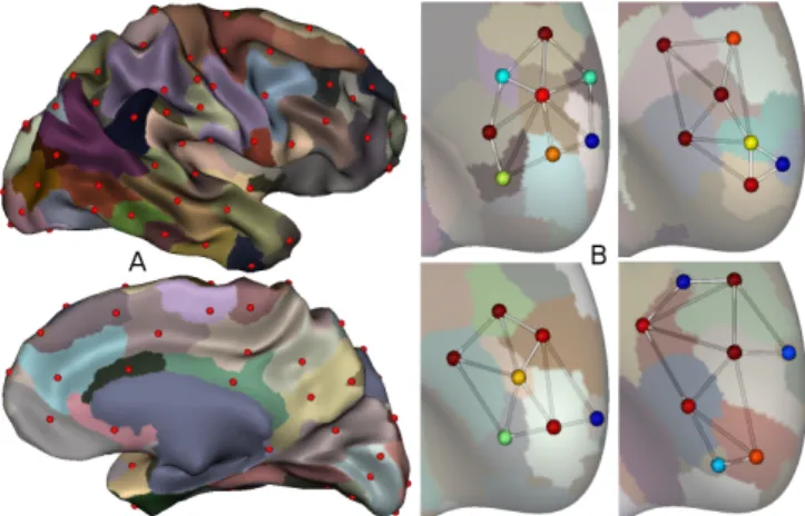 Fig. 1. A. Illustration of the sulcal pits and their basins on one subject. B. Examples of sulcal pit graphs in the right frontal lobe for four subjects (the color of the nodes encodes the relative depth of the pit, from red (deep) to blue (shallow).