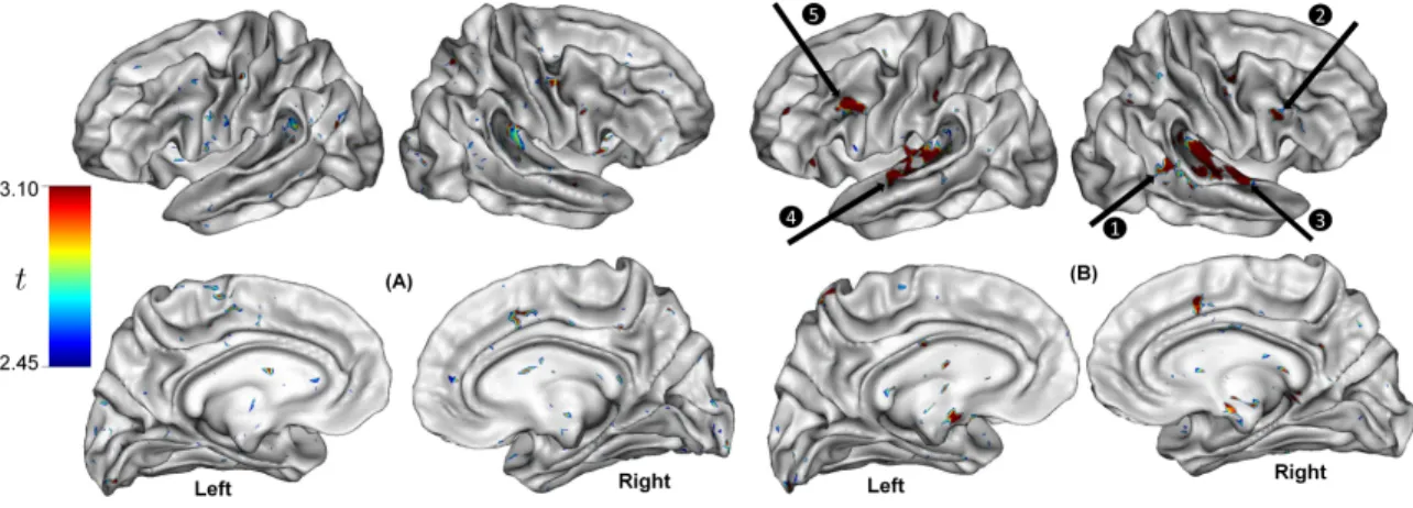 Fig. 5. Average weight maps estimated using our task+rest fMRI-based predictive model of individual differences, thresholded after a test for statistical significance (t > 2.45, p < 0.005)