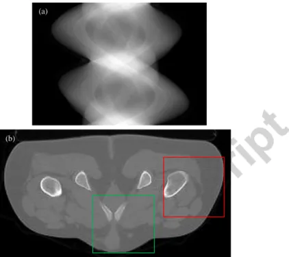 Fig.  8:  (a)  the  complete  pelvis  projection  data.  (b)  image  reconstructed  with  TV  regularization