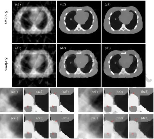 Fig. 4: Reconstructed images of the NACT phantom. (a1)-(a3), (b1)-(b3), (c1)-(c3) and (d1)-(d3) are the reconstructed images using  the  l 2 -norm  regularization,  TV  regularization  and  the  Gamma  regularization  with  11  views,  10  views,  9  views