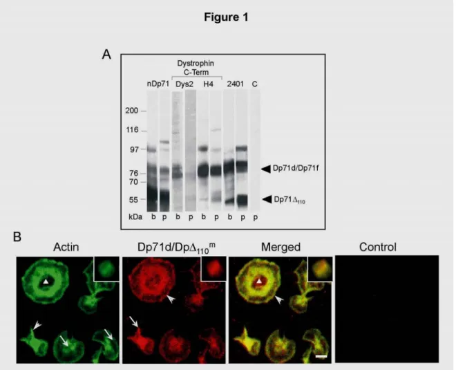 Figure 1. Detection and topographical distribution of short dystrophins in human platelets