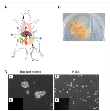 FIGURE 1 | Enzymatic digestion of the liver. (A) Set-up for in situ liver perfusion. A catheter is inserted into the portal vein (blue threads) and connected to the perfusion tubing