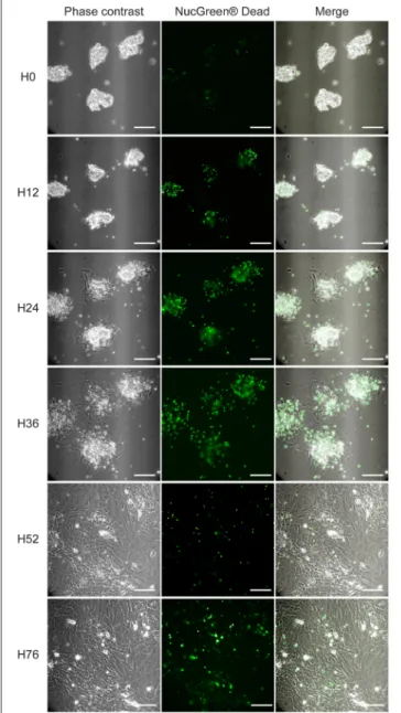 FIGURE 2 | PMF outgrowth in culture. PMF culture in complete medium (i.e., supplemented with 10% FBS), containing NucGreen ® Dead reagent to monitor cell death, was observed by Video-Microscopy (Supplementary Video)
