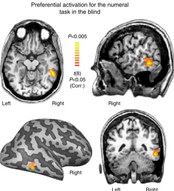 Figure 2 | Preferential activation for the Numeral task in the blind.