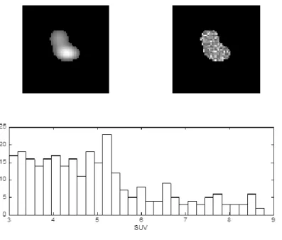 Figure  1  :  Heterogeneity  measures  do  not  characterize  the  spatial  relationships  between  voxels