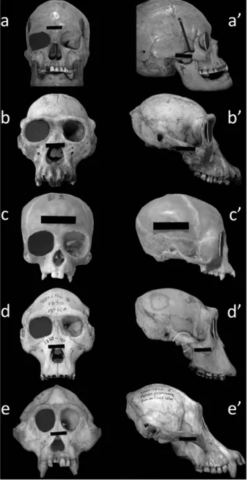 Figure 4.  The human orbital margin falls short of being inscribed in a plane. Front and side views  of human and ape skulls