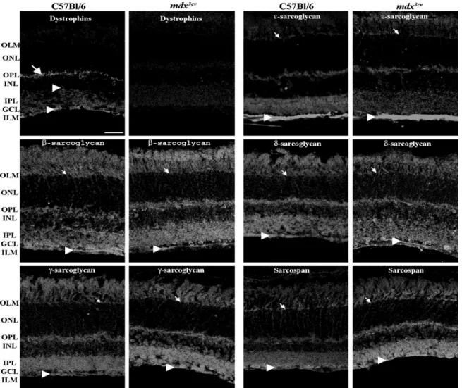 Fig. 2. Immunohistochemical analysis of the dystrophins and sarcoglycan–sarcospan complex components in  wild-type (C57Bl/6) and mdx 3cv  mice retinae