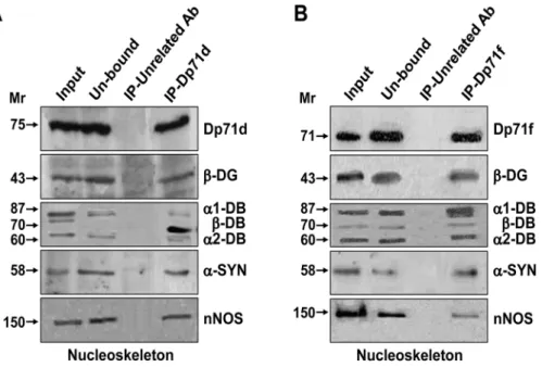 Fig 4. Dp71s-DAP complexes immunoprecipitated from nucleoskeleton fraction of hippocampal neurons