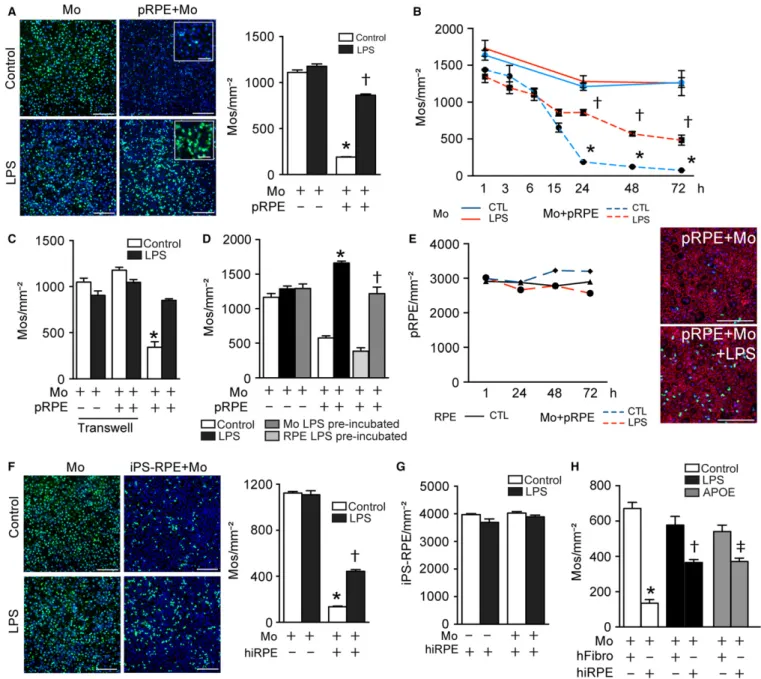 Fig. 1 The RPE efficiently eliminates na € ıve- but not activated monocytes in vitro. (A) Representative pictures and quantification of CFSE labeled Mos at 24 h in monoculture (left panels) and pRPE/Mo coculture (right panels), incubated without (upper pan