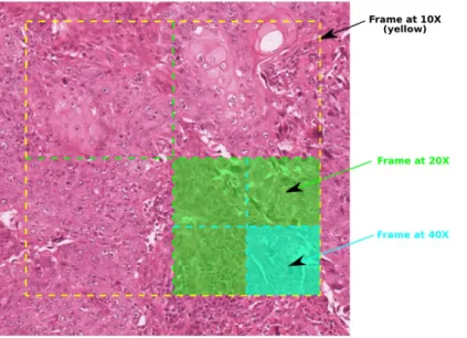 Figure 2: WSI exploration model for digital pathology [2].