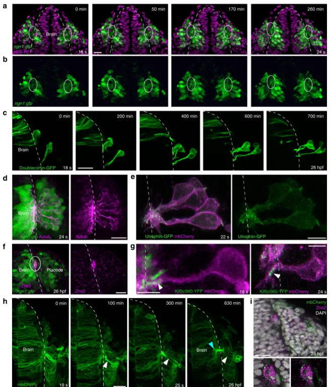 Fig. 3 Axonal identity of the cytoplasmic protrusions. All images represent dorsal views; dotted white lines indicate the brain surface