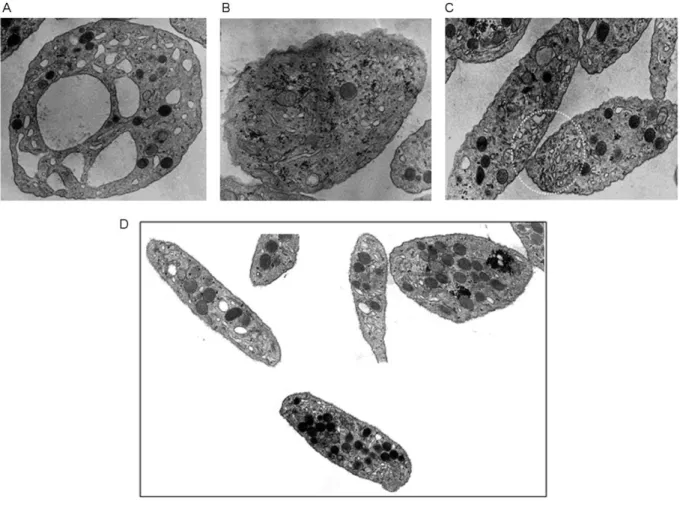 Figure 3 : Platelet of δ-SPD patients (A, B, and C) in comparison with controls (D). Electron  microscopy of thin sections of platelets with larges 