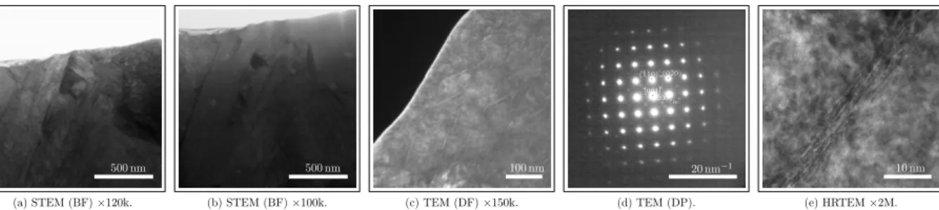 Figure 9: Micrographs of alloy 16NiCrMo13 nitrided, quenched and submitted to cryogenic treatment: (a) bright field (BF) showing the lath martensite structure, (b) high temperature MN-nitrides, (c) dark field (DF) oriented according to the reflexion indica