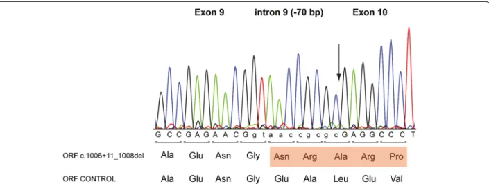 Figure 2 Sequencing analysis of (c.1006 + 11_1008del) gAMN8-12 minigene mRNA transcript