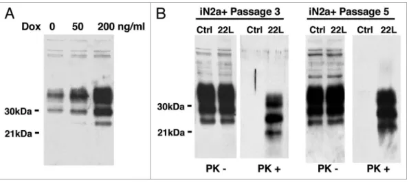 Figure 1. Western blot of the cell extracts after PrP C  induction &amp; infection. (A) iN2a cells were cultured for three days with increasing amounts of  doxycycline