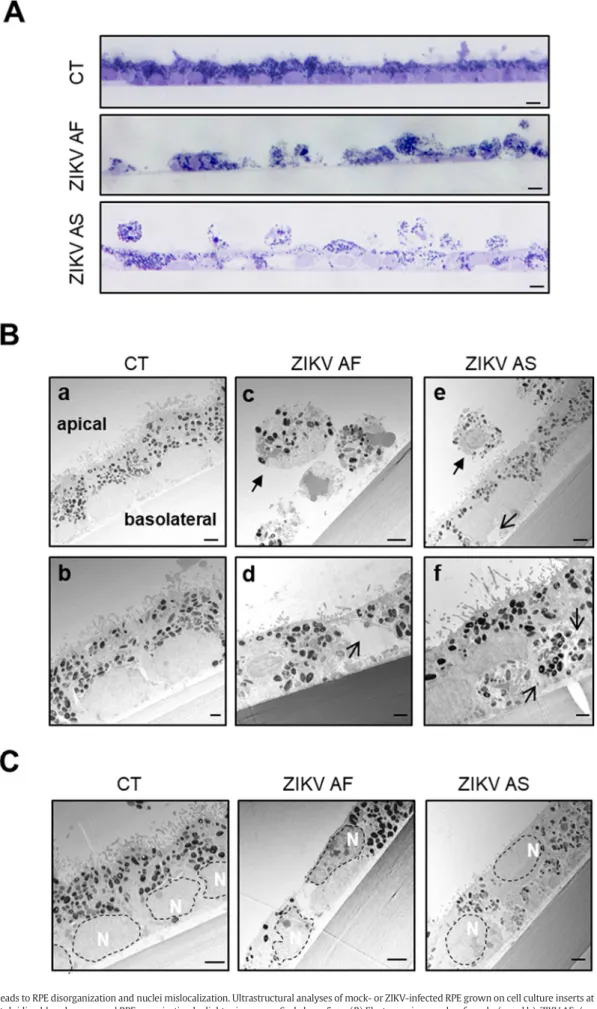 Fig. 2.ZIKV infection leads to RPE disorganization and nuclei mislocalization. Ultrastructural analyses of mock- or ZIKV-infected RPE grown on cell culture inserts at 10 dpi