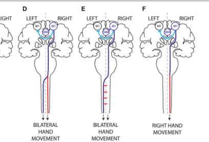 FIGURE 1 | Hypothetical mechanisms of mirror movements. (A) In humans, execution of a unilateral left hand movement requires both lateralized activation of the right primary motor cortex (M1) by interhemispheric inhibition (IHI) and proper motor planning a