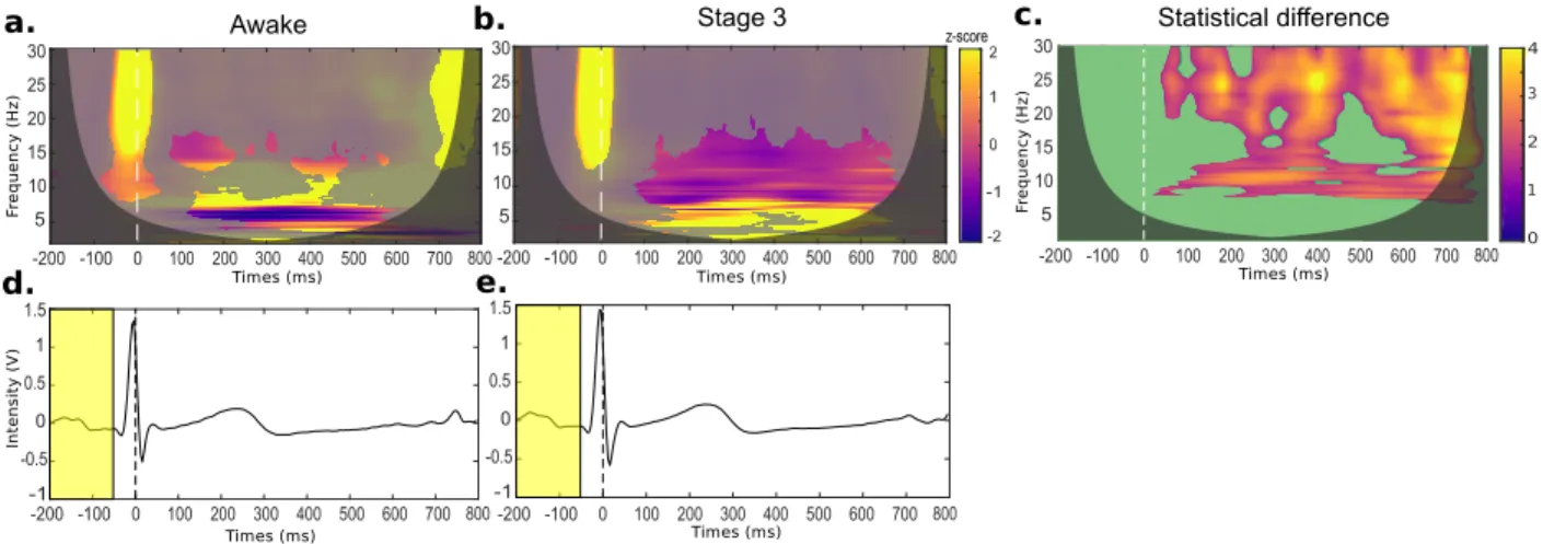 Figure 7: Heartbeat event-related potentials during wakefulness and sleep stage 3 conditions for a healthy subject
