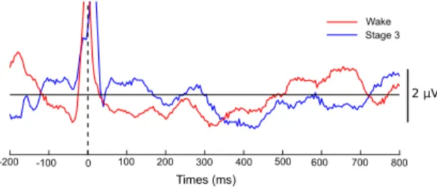 Figure 1: Example of respiratory event-related potential. Av- Av-eraged amplitude across the epochs of the central EEG activity (Cz electrode) of a subject during spontaneously breathing (in red) or during an inspiratory load task (in blue)