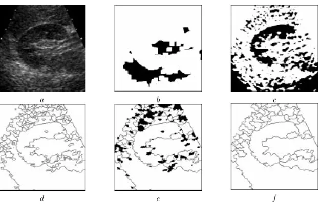 Fig. 1.26  Marquage par haut-de-forme d'une image faiblement contrastée et bruitée.