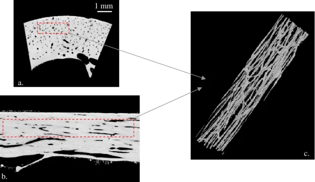 Figure 3.5 : Microarchitecture de la porosité intracorticale, évaluée par microtomographie  synchrotron 3D