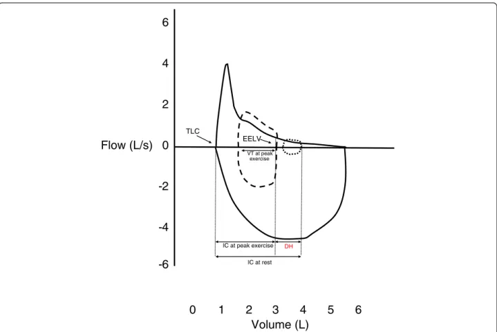 Fig. 2 Dynamic hyperinflation. This is a real-life example of a 51 years-old woman with severe COPD (FEV 1 /FVC ratio 0.50, FEV 1 1.31 L, 47 % predicted) who performed inspiratory capacity maneuvers during incremental cardiopulmonary exercise testing of cy