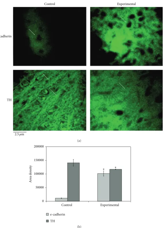 Figure 3: (a) Fluorescence immunostaining of e-cadherin and tyrosine hydroxylase (TH) by using specific antibodies in the substantia nigra area of control and experimental midbrain