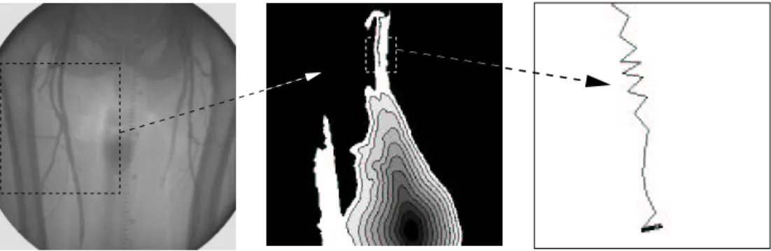 Figure 1.6. Failure of the steepest gradient descent on a bolus chase reconstruction data