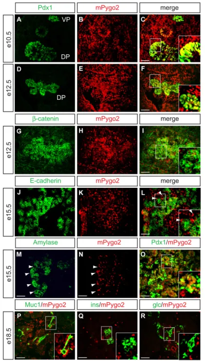 Figure 1. mPygo2 is expressed in the pancreatic epithelium and mesenchyme