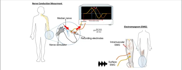 FIGURE 1 | Schematic representation of the nerve conduction and muscle contraction studies