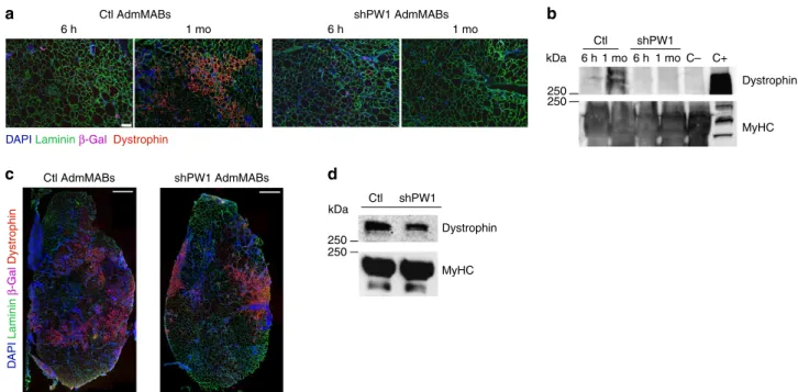 Figure 4 | PW1-silenced MABs do not rescue the dystrophic phenotype after intra-arterial transplantation in scid-mdx mouse