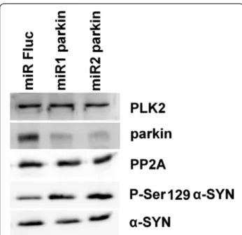 Figure 7 Increased P-S129 α -SYN in human SHSY5Y neuroblastoma cells after parkin knockdown
