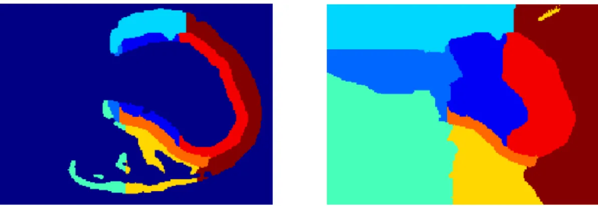 Fig. 3.8 – Diagrammes de Vorono¨ı des zones anatomiques. Gauche : image initiale, droite : diagrammes correspondants.