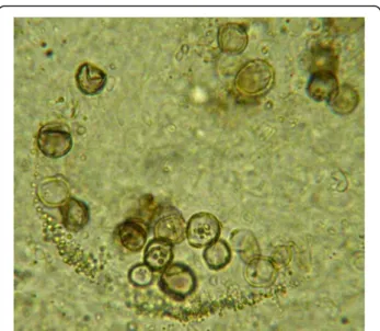 Fig. 3 Microscopic examination of the fungal culture collected from the right thigh lesion