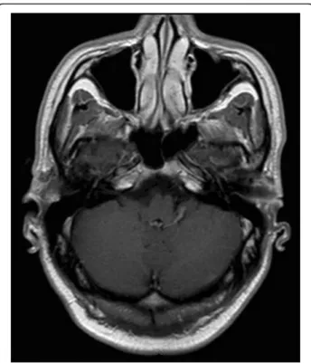 Fig. 5 MRI of the central nervous system 3 months after amoxicillin treatment and posaconazole initiation
